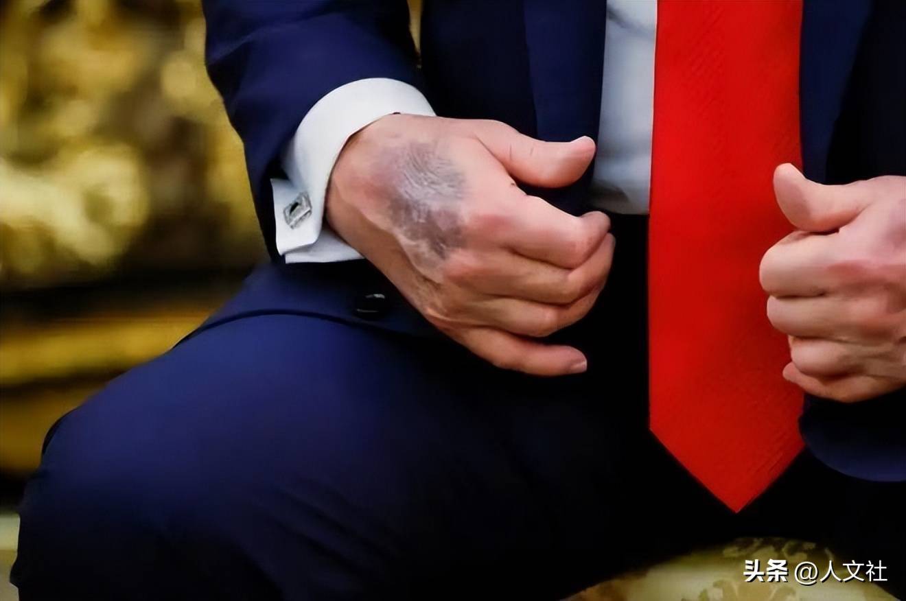 钱再多也得服老79岁特朗普身家525亿这遭遇给老年人敲了警钟(图2)